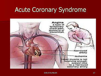 Recognizing and Managing Acute Coronary Syndrome