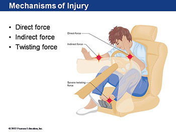 Musculoskeletal Injuries