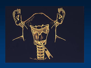 Maxillofacial Trauma