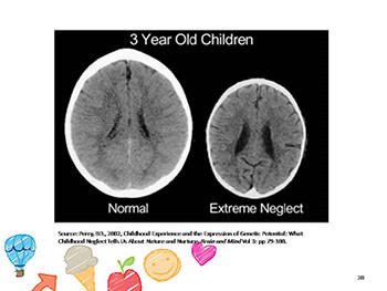 Young children and trauma