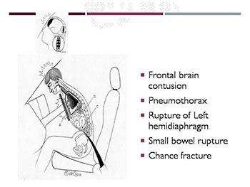 Trauma-Epidemiology Warfare Injuries Mechanism of Injury