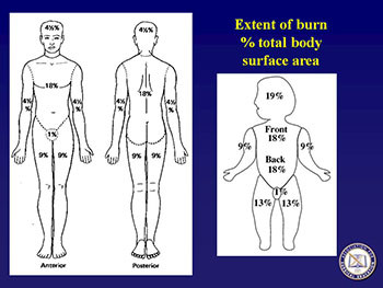 Burns Initial Evaluation and Management