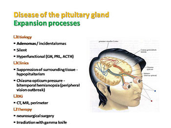 Diseases Of Hypothalamus And Hypophysis