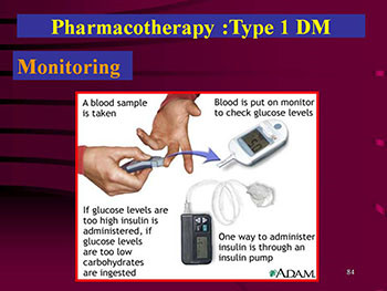 Diabetes Mellitus