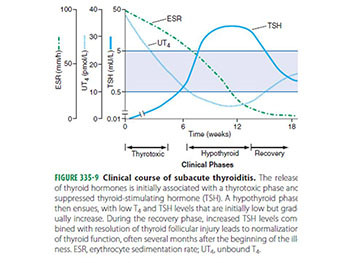 Hyperthyroidism