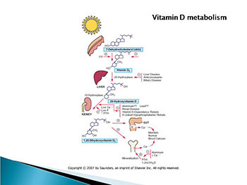 Rickets and Metabolic Bone Diseases