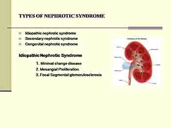 NEPHROTIC SYNDROME