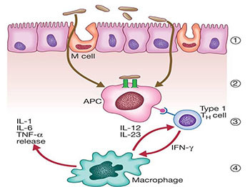 Inflammatory Bowel Diseases