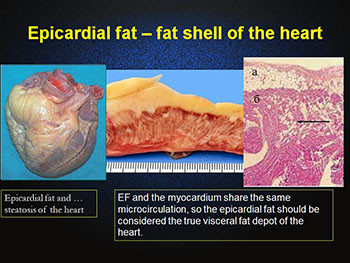 Atherosclerosis Is The Liver Disease