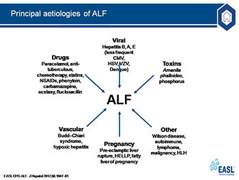 Acute Liver Failure