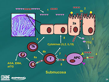 Celiac Disease