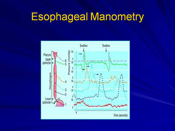 About Esophageal Motility Disorders