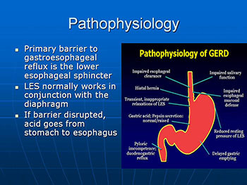 Gastroesophageal Reflux Disease