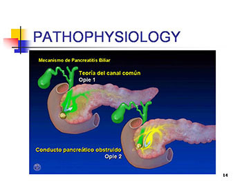The Management of Acute Pancreatitis