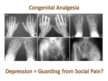 Pain and Depression in Older Adults