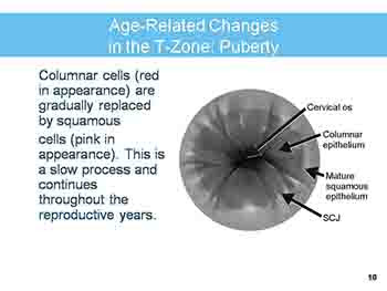 Cervical cancer screening