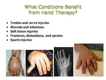 What is Hand Therapy