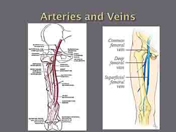 Deep Vein Thrombosis