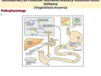 Anemia