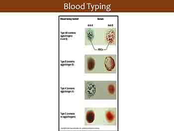 Blood Transfusion Physiology