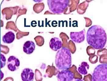 Leukemia