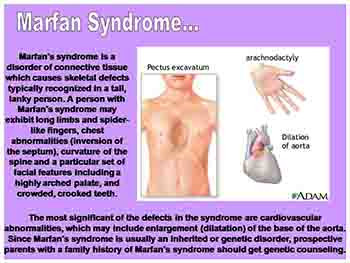 Birth defects