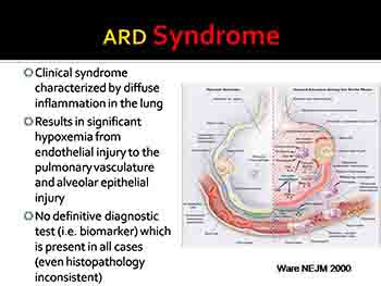 Defining Pediatric ARDS-Past and Future