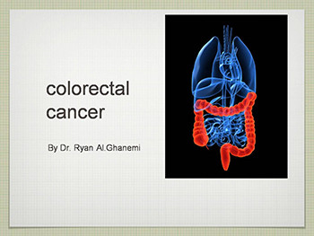 Colorectal Cancer