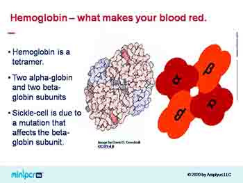 Sickle Cell Genetics