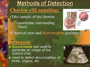 Mutations and Genetic Disorders