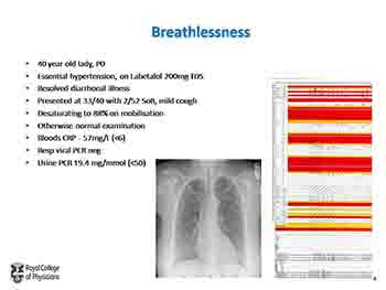 Acute Medical Presentations In Pregnancy