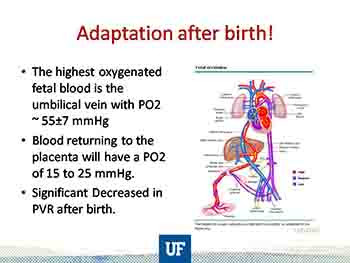 Pulmonary Complications of Congenital Heart Disease