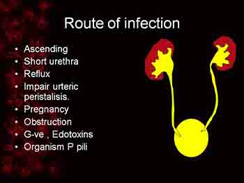 Urinary Tract Infection