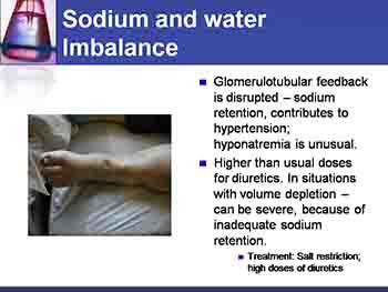 Chronic Kidney Disease