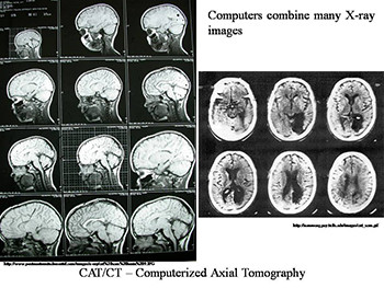 Brain Scans