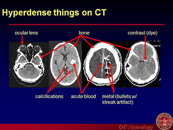 Introduction To Head Ct Imaging