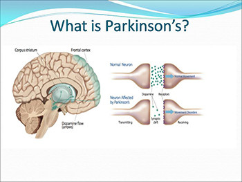 Introduction To Parkinsons
