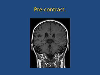 Neuroimaging Pearls For The Primary Care Provider