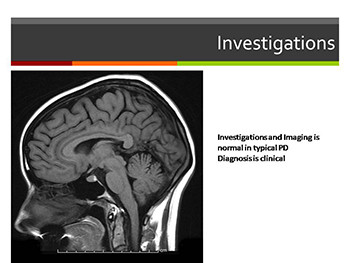 About Movement Disorders