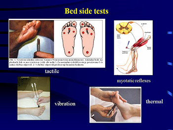 Neuromuscular Diseases