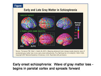 About Schizophrenia