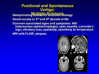 Dizziness And Vertigo