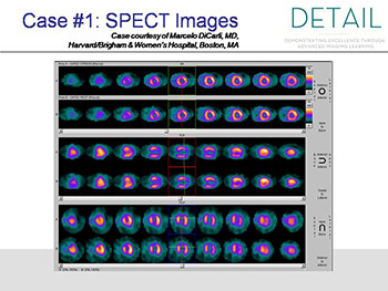 Pet Myocardial Perfusion Imaging-MPI