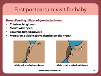 Care After Delivery-Postpartum Care
