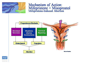 Overview of Medical Abortion-Clinical And Practice Issues
