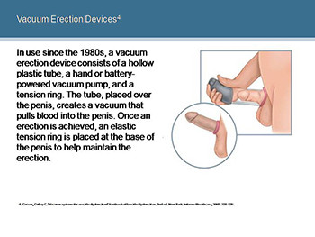 Your Treatment Options For Erectile Dysfunction