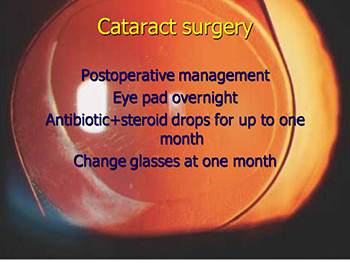 Cataract And Implant Surgery