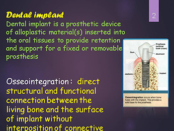 Impression Techniques of Dental Implants