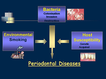 Epidemiology of Periodontal Diseases