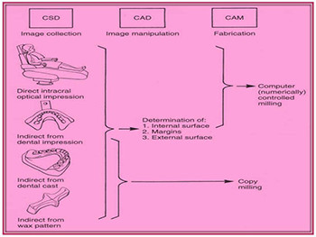 Cad-Cam in Restorative Dentistry